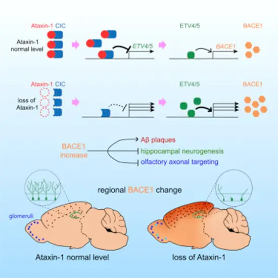 sca-1 (spinocerebellar ataxia): atxn1 gene mutation